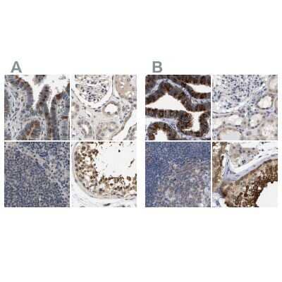 <b>Independent Antibodies Validation. </b>Immunohistochemistry-Paraffin: RUVBL1 Antibody [NBP1-84913] - Staining of human fallopian tube, kidney, lymph node and testis using Anti-RUVBL1 antibody NBP1-84913 (A) shows similar protein distribution across tissues to independent antibody NBP1-84914 (B).