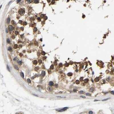 Immunohistochemistry-Paraffin: RUVBL1 Antibody [NBP1-84913] - Staining of human testis.