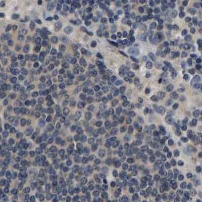 Immunohistochemistry-Paraffin: RUVBL1 Antibody [NBP1-84913] - Staining of human lymph node.