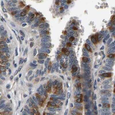 Immunohistochemistry-Paraffin: RUVBL1 Antibody [NBP1-84913] - Staining of human fallopian tube using Anti-RUVBL1 antibody NBP1-84913.