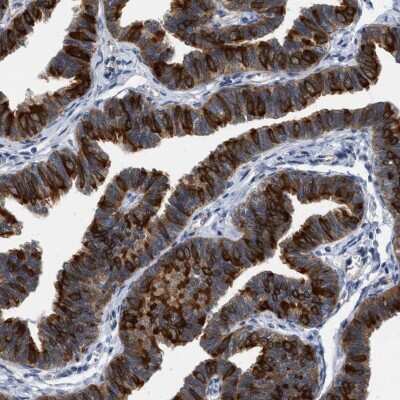 Immunohistochemistry-Paraffin: RUVBL1 Antibody [NBP1-84914] - Staining of human fallopian tube shows high expression.