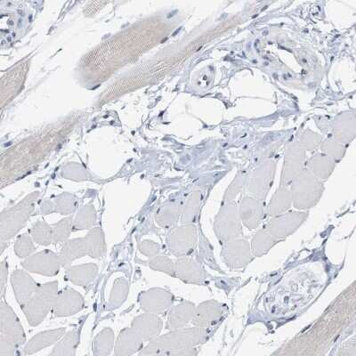 Immunohistochemistry-Paraffin: RUVBL1 Antibody [NBP1-84914] - Staining of human skeletal muscle shows low expression as expected.