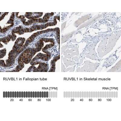 <b>Orthogonal Strategies Validation. </b>Immunohistochemistry-Paraffin: RUVBL1 Antibody [NBP1-84914] - Staining in human fallopian tube and skeletal muscle tissues using anti-RUVBL1 antibody. Corresponding RUVBL1 RNA-seq data are presented for the same tissues.