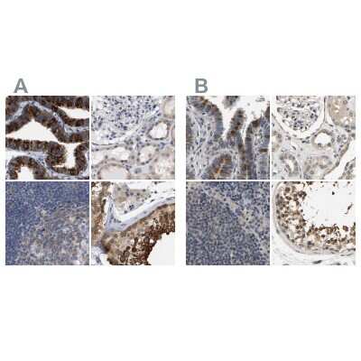 <b>Independent Antibodies Validation. </b>Immunohistochemistry-Paraffin: RUVBL1 Antibody [NBP1-84914] - Staining of human fallopian tube, kidney, lymph node and testis using Anti-RUVBL1 antibody NBP1-84914 (A) shows similar protein distribution across tissues to independent antibody NBP1-84913 (B).