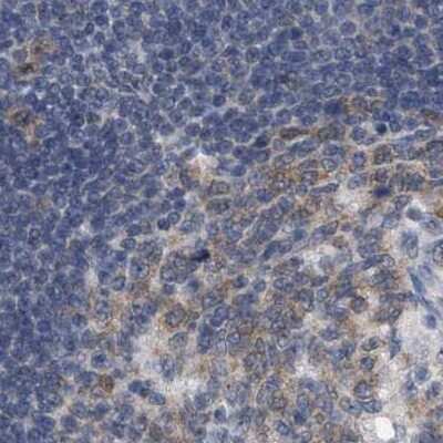 Immunohistochemistry-Paraffin: RUVBL1 Antibody [NBP1-84914] - Staining of human lymph node.