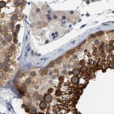 Immunohistochemistry-Paraffin: RUVBL1 Antibody [NBP1-84914] - Staining of human testis.