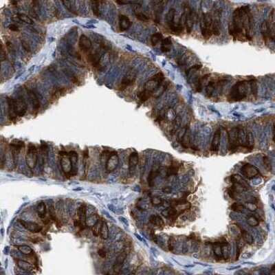 Immunohistochemistry-Paraffin: RUVBL1 Antibody [NBP1-84914] - Staining of human fallopian tube using Anti-RUVBL1 antibody NBP1-84914.