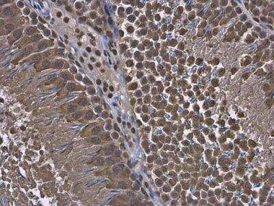 Immunohistochemistry-Paraffin: RUVBL1 Antibody [NBP2-20245] - Rat testis. RUVBL1 antibody diluted at 1:500. Antigen Retrieval: Citrate buffer, pH 6.0, 15 min.