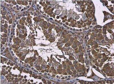 Immunohistochemistry-Paraffin: RUVBL1 Antibody [NBP2-20245] - Mouse testis. RUVBL1 antibody diluted at 1:500. Antigen Retrieval: Citrate buffer, pH 6.0, 15 min.