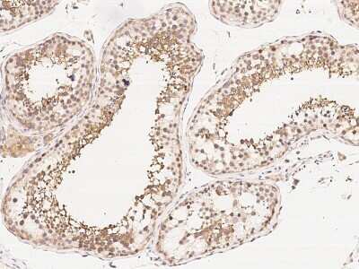 Immunohistochemistry-Paraffin: RUVBL1 Antibody [NBP2-99030] - Immunochemical staining of human RUVBL1 in human testis with rabbit polyclonal antibody (1:1000, formalin-fixed paraffin embedded sections).