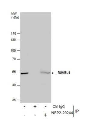 Immunoprecipitation: RUVBL1 Antibody [NBP2-20244] -  Immunoprecipitation of RUVBL protein from Jurkat whole cell extracts using 5 ug of RUVBL1 antibody. Western blot analysis was performed using RUVBL1 antibody. EasyBlot anti-Rabbit IgG was used as a secondary reagent.