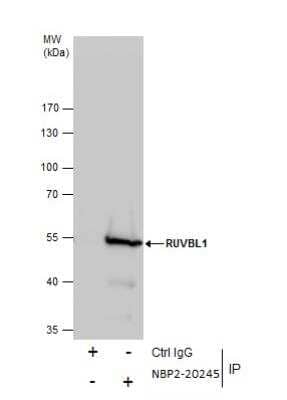 Immunoprecipitation: RUVBL1 Antibody [NBP2-20245] - Immunoprecipitation of RUVBL protein from Jurkat whole cell extracts using 5 ug of RUVBL1 antibody. Western blot analysis was performed using RUVBL1 antibody. EasyBlot anti-Rabbit IgG  was used as a secondary reagent.