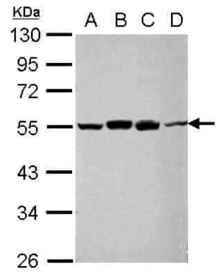 Western Blot: RUVBL1 Antibody [NBP2-20244] - Sample (30 ug of whole cell lysate) A: A549 B: H1299 C: HCT116 D: MCF-7 10% SDS PAGE gel, diluted at 1:1000.