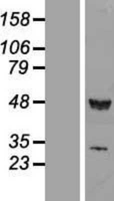 Western Blot RUVBL1 Overexpression Lysate