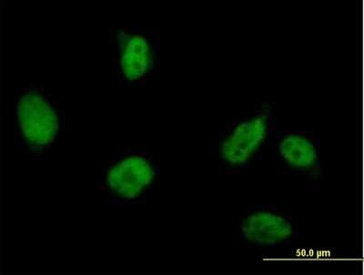 Immunocytochemistry/Immunofluorescence: RUVBL2 Antibody [H00010856-B01P] - Analysis of purified antibody to RUVBL2 on HeLa cell. (antibody concentration 10 ug/ml)