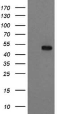 Western Blot: RUVBL2 Antibody (OTI2B9) - Azide and BSA Free [NBP2-73960] - Analysis of HEK293T cells were transfected with the pCMV6-ENTRY control (Left lane) or pCMV6-ENTRY RUVBL2.