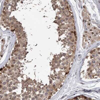 Immunohistochemistry-Paraffin: RWDD2A Antibody [NBP1-85168] - Staining of human testis shows strong cytoplasmic and nuclear positivity in cells in seminiferous ducts.