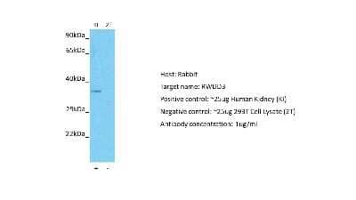 Western Blot RWDD3 Antibody