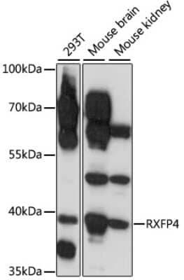 Western Blot: RXFP4/GPCR142/GPR100 Antibody [NBP2-94509] - Analysis of extracts of various cell lines, using RXFP4/GPCR142/GPR100 . Exposure time: 1s.