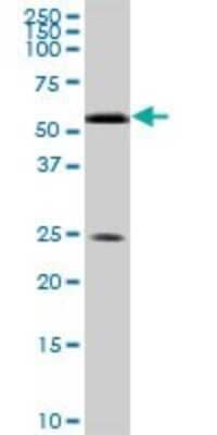 Western Blot: RXR alpha/NR2B1 Antibody (1D7) [H00006256-M05] - Analysis of RXRA expression in human ovarian cancer.