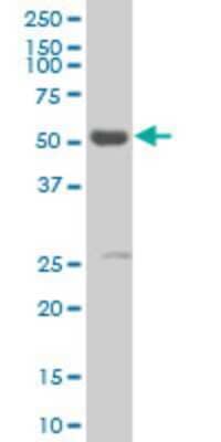 Western Blot: RXR alpha/NR2B1 Antibody (1D7) [H00006256-M05] - Analysis of RXRA expression in human skin.