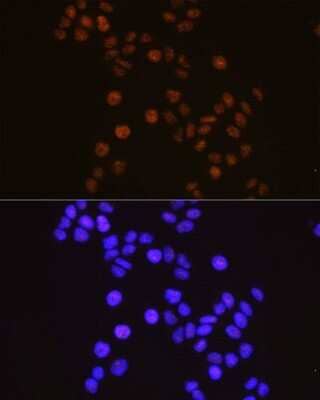 Immunocytochemistry/ Immunofluorescence RXR alpha/NR2B1 Antibody (6Y10M1)