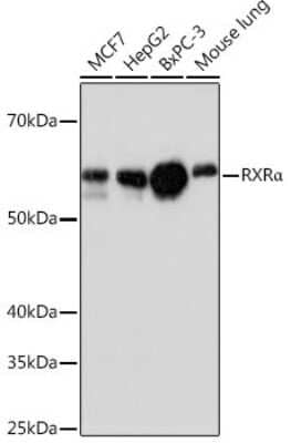 Western Blot RXR alpha/NR2B1 Antibody (6Y10M1)