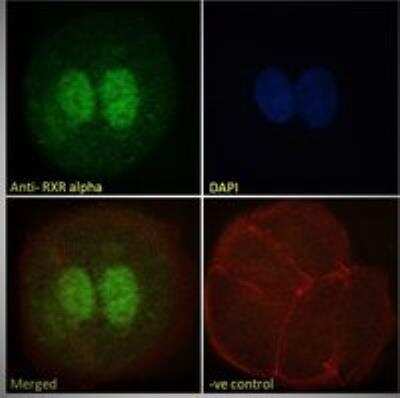 Immunocytochemistry/Immunofluorescence: RXR alpha/NR2B1 Antibody [NB100-1466] - Immunofluorescence analysis of paraformaldehyde fixed MCF7 cells, permeabilized with 0.15% Triton. Primary incubation 1hr (10 ug/mL) followed by Alexa Fluor 488 secondary antibody (2 ug/mL), showing strong nuclear staining. Actin filaments were stained with phalloidin (red) and the nuclear stain is DAPI (blue). Negative control: Unimmunized goat IgG (10 ug/mL) followed by Alexa Fluor 488 secondary antibody (2 ug/mL).