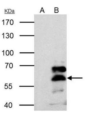 Immunoprecipitation: RXR alpha/NR2B1 Antibody [NBP2-20130] - A. Control with 4 ug of preimmune Rabbit IgG.B. Immunoprecipitation of RXRA protein by 4 ug Retinoid X Receptor alpha antibody.