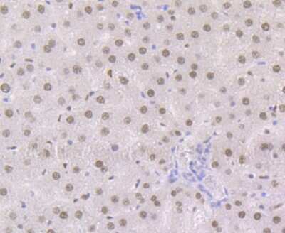 Immunohistochemistry-Paraffin: RXR alpha/NR2B1 Antibody (JG99-38) [NBP2-75653] - Analysis of paraffin-embedded rat liver tissue using anti-Retinoid X Receptor alpha antibody. Counter stained with hematoxylin.