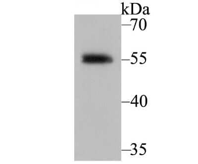 Western Blot: RXR alpha/NR2B1 Antibody (JG99-38) [NBP2-75653] - Analysis of Retinoid X Receptor alpha on MCF-7 cell using anti-Retinoid X Receptor alpha antibody at 1/5,000 dilution.