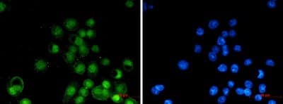 Immunocytochemistry/Immunofluorescence: RXR alpha/NR2B1 Antibody (S04-6C3) [NBP3-19972] - Immunocytochemistry of RXR alpha/NR2B1 (green) in MCF-7 using NBP3-19972 at dilution 1/20, and DAPI (blue)