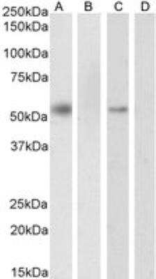 Western Blot: RXR alpha/NR2B1 Antibody [NB100-1466] - Western blot analysis of nuclear HeLa cell lysate (A) + peptide (B) and nuclear K562 cell lysate (C) + peptide (D). 35 ug protein in RIPA buffer. Antibody at 0.3 ug/mL. Detected by chemiluminescence.