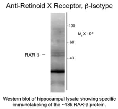 Western Blot: RXR beta/NR2B2 Antibody (147) [NB300-311]