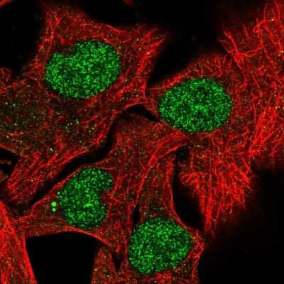 Immunocytochemistry/Immunofluorescence: RXR beta/NR2B2 Antibody [NBP2-57755] - Staining of human cell line SK-MEL-30 shows localization to nucleus. Antibody staining is shown in green.