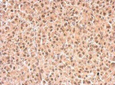 Immunohistochemistry-Paraffin: RXR beta/NR2B2 Antibody [NBP1-33543] - Paraffin-embedded HBL435 xenograft. Retinoid X Receptor beta antibody dilution: 1:500.
