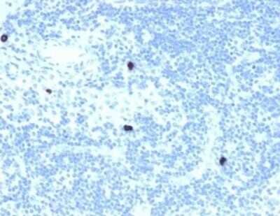 Immunohistochemistry-Paraffin: RXR beta/NR2B2 Antibody (PCRP-RXRB-2B6) [NBP3-08445] - Formalin-fixed, paraffin-embedded human lymph node stained with RXR beta/NR2B2 Mouse Monoclonal Antibody (PCRP-RXR beta/NR2B2-2B6).