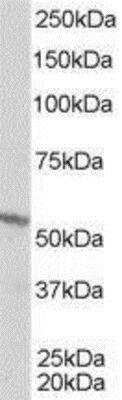 Western Blot: RXR beta/NR2B2 Antibody [NB100-1467] - (1ug/ml) of A431 lysate (RIPA buffer, 35ug total protein per lane). Primary incubated for 1 hour. Detected by western blot using chemiluminescence.