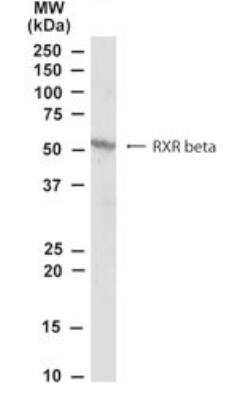 Western Blot RXR beta/NR2B2 Antibody