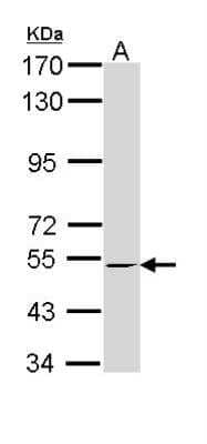 Western Blot: RXR beta/NR2B2 Antibody [NBP1-33543] - Sample (30 ug of whole cell lysate) A: Molt-4 7.5% SDS PAGE; antibody diluted at 1:1000.