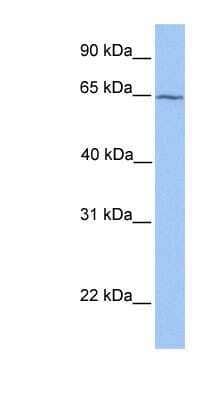 Western Blot: RXR beta/NR2B2 Antibody [NBP1-52812] - Jurkat cell lysate, concentration 0.2-1 ug/ml.