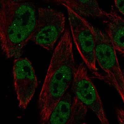 Immunocytochemistry/Immunofluorescence: RXR gamma/NR2B3 Antibody [NBP2-68585] - Staining of human cell line SK-MEL-30 shows localization to nucleoplasm & nuclear bodies. Antibody staining is shown in green.