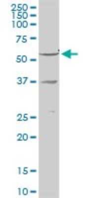 Western Blot: RXR gamma/NR2B3 Antibody [H00006258-D01P] - Analysis of RXRG expression in human liver.