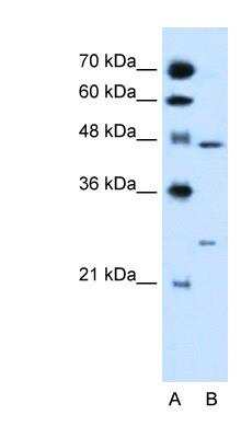Western Blot: RXR gamma/NR2B3 Antibody [NBP1-52815] - HepG2 cell lysate, concentration 0.2-1 ug/ml.