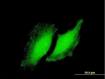 Immunocytochemistry/Immunofluorescence: RYBP/DEDAF Antibody [H00023429-B01P] - Analysis of purified antibody to RYBP on HeLa cell. (antibody concentration 10 ug/ml)
