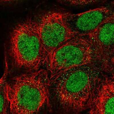 Immunocytochemistry/Immunofluorescence: RYBP/DEDAF Antibody [NBP2-49083] - Staining of human cell line A-431 shows localization to nucleoplasm. Antibody staining is shown in green.