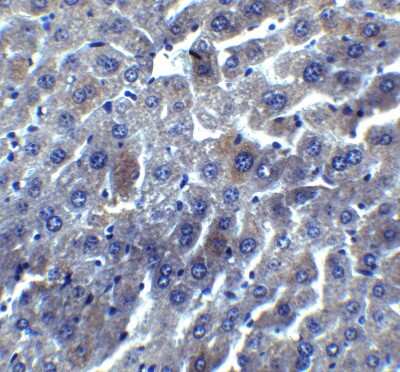 Immunohistochemistry: RYBP/DEDAF Antibody [NBP1-76842] - Staining of mouse liver tissue with antibody at 5 ug/mL.