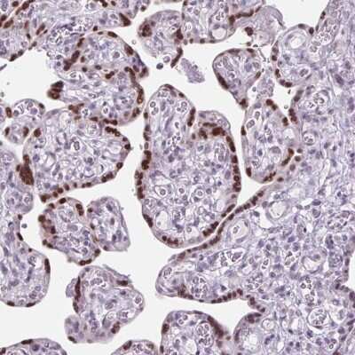 Immunohistochemistry-Paraffin: RYBP/DEDAF Antibody [NBP2-49083] - Staining of human placenta shows strong nuclear positivity in trophoblastic cells.