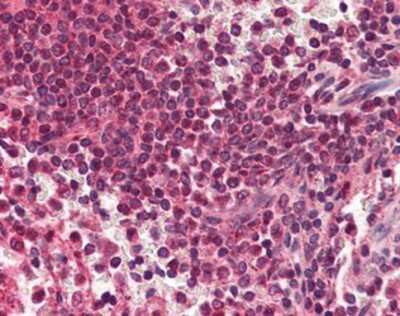 Immunohistochemistry-Paraffin: RYBP/DEDAF Antibody [NBP1-03095] - Staining of human spleen. Immunohistochemistry of formalin-fixed, paraffin-embedded tissue after heat-induced antigen retrieval. Antibody concentration 5 ug/ml.