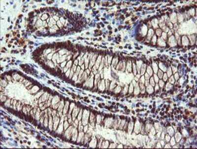 Immunohistochemistry: RYBP/DEDAF Antibody (OTI1B2) - Azide and BSA Free [NBP2-73961] - Staining of paraffin-embedded Human colon tissue using anti-RYBP/DEDAF mouse monoclonal antibody.